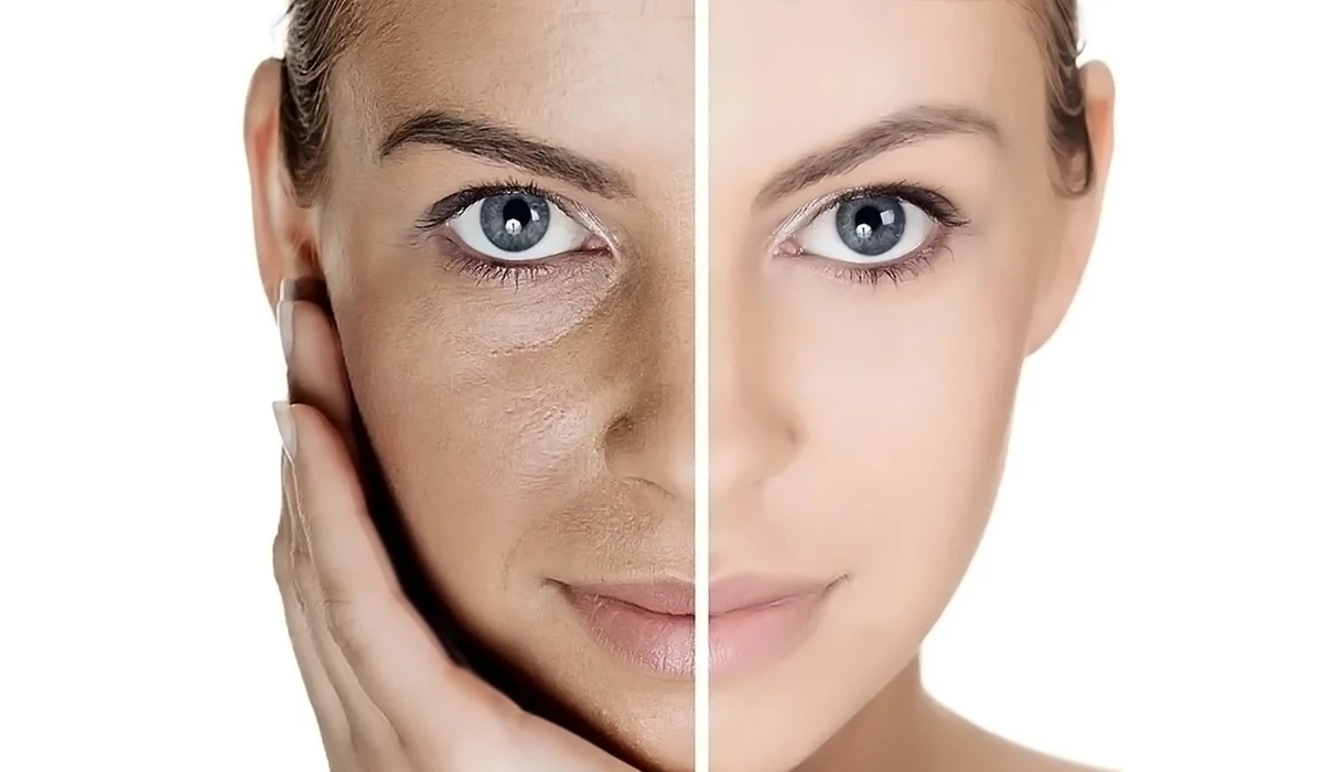جوان‌سازی پوست