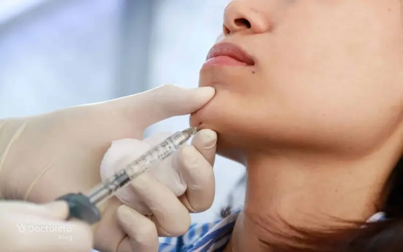 زاویه‌ سازی صورت و فک